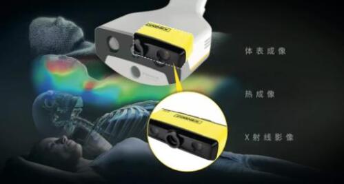 The Cognex 3D-A5060 3D area array vision system enables precise radiotherapy and a new dimension of human positioning monitoring